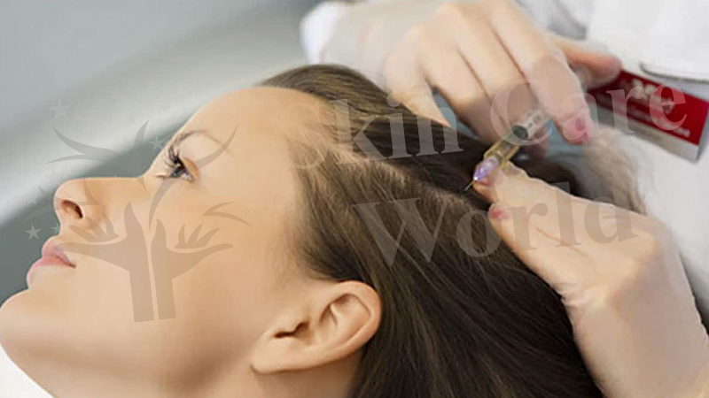 Mesotherapy Hair Treatment in Gurgaon